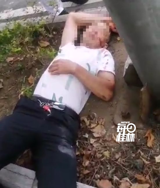 168体育 168体育官网事发环城西一路一男子半个脸是血倒在绿化带里不省人事什么情况？(图1)